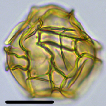 Impagidinium dispertitum Impsp33XCC2051100b.jpg